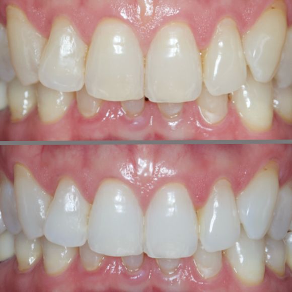 Resultado Dental Concept 1